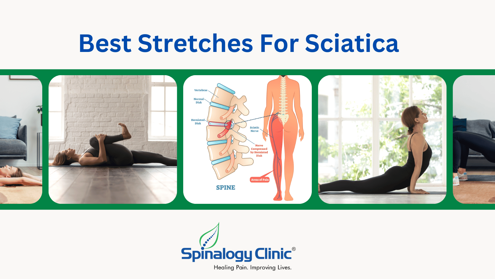 Best Stretches For Sciatica